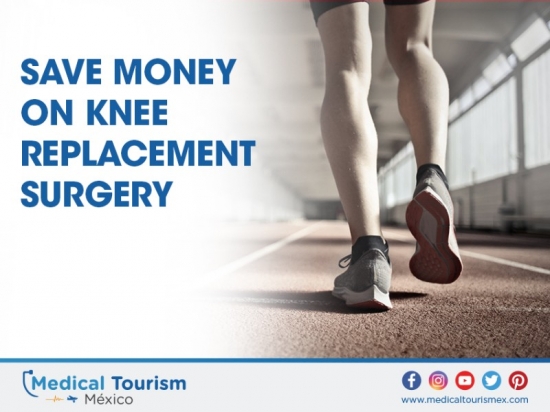 Save money on knee replacement in San Luis Potosi